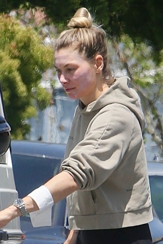 JESSICA HART Leaves a Facial Clinic in Beverly Hills 05/02/2024